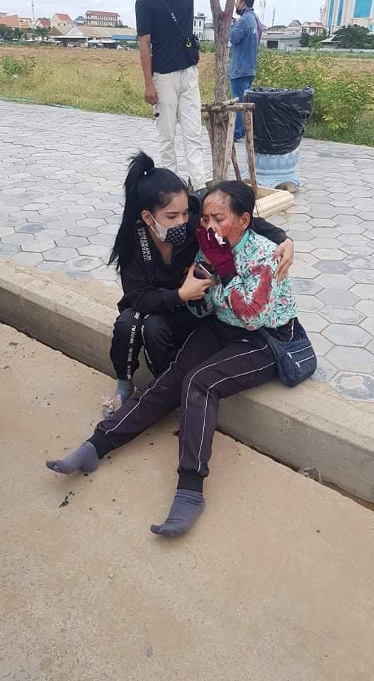 ស្រ្តីម្នាក់ ជិះម៉ូតូមួយគ្រឿង បុកពីក្រោយគូថរថយន្តពេញទំហឹង បណ្តាលឱ្យរងរបួសធ្ងន់