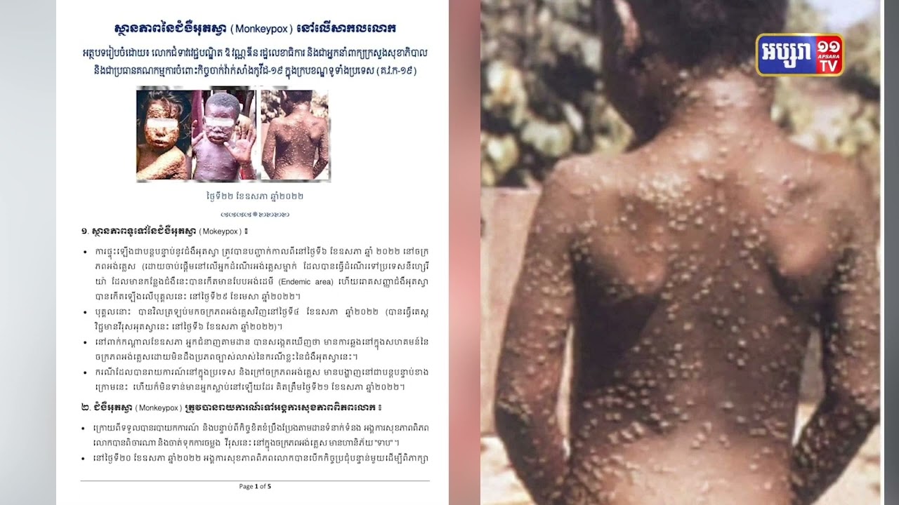 កម្ពុជាប្រុងប្រយ័ត្នជម្ងឺអុតស្វា (Video Inside)