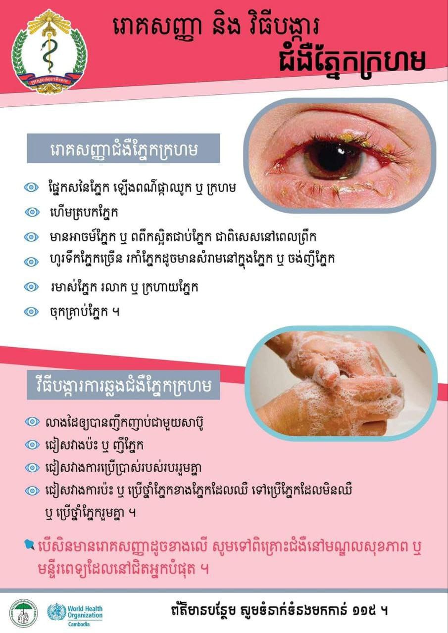 មន្ទីរសុខាភិបាលខេត្តកំពង់ឆ្នាំង រកឃើញពលរដ្ឋជិត២០០នាក់ បានឆ្លងជំងឺភ្នែកក្រហម