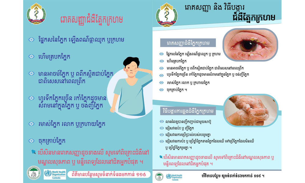 ក្រសួងសុខាភិបាល ក្រើនរំឮកពលរដ្ឋឱ្យប្រុងប្រយ័ត្នជំងឺភ្នែកក្រហម ខណៈជំងឺនេះកំពុងឆ្លងថ្មីគួរឱ្យកត់សម្គាល់