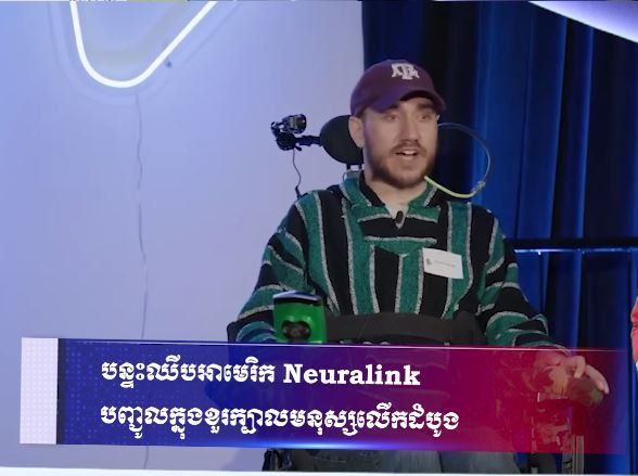 បន្ទះឈីបអាមេរិក Neuralink បញ្ជូលក្នុងខួរក្បាលមនុស្សលើកដំបូង