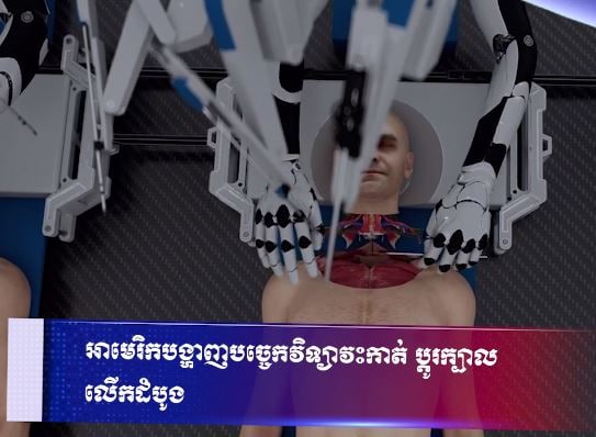អាមេរិកបង្ហាញបច្ចេកវិទ្យាវះកាត់ ប្តូរក្បាល លើកដំបូង