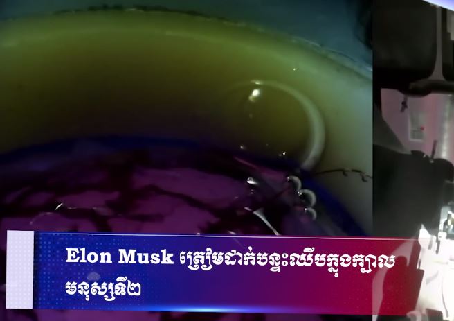 Elon Musk ត្រៀមដាក់បន្ទះឈីបក្នុងក្បាលមនុស្សទី២ ត្រៀមដាក់បន្ទះឈីបក្នុងក្បាលមនុស្សទី២