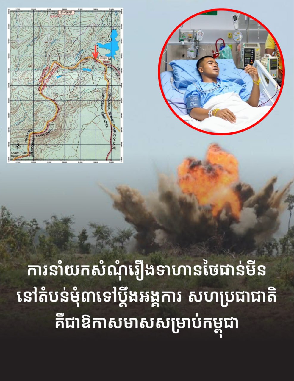 «ការនាំយកសំណុំរឿងទាហានថៃជាន់មីននៅតំបន់មុំ៣ទៅប្តឹងអង្គការ សហប្រជាជាតិគឺជាឱកាសមាស សម្រាប់កម្ពុជា»